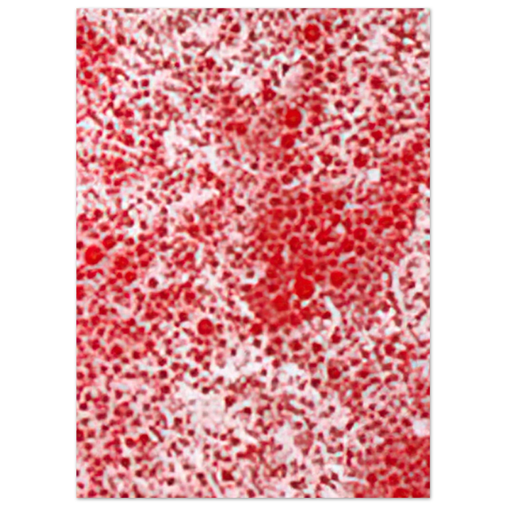 Yayoi Kusama - BEYOND THE END OF THE CENTURY 1987 Fine Art Poster