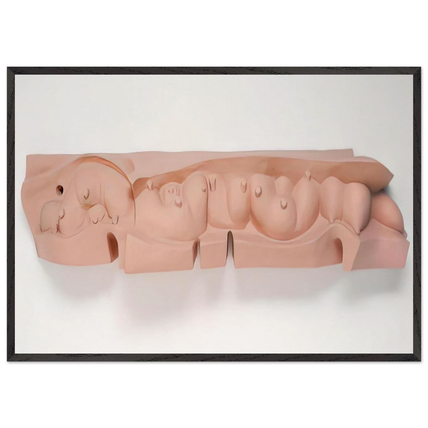 MAMELLES 1991 - Louise Bourgeois 70x100 cm / 28x40 inches Framed Art Print – Black Wooden Frame