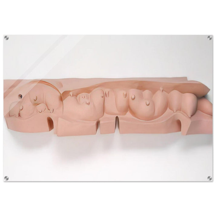 MAMELLES 1991 - Louise Bourgeois Acrylic Print - 70x100 cm / 28x40″ inches