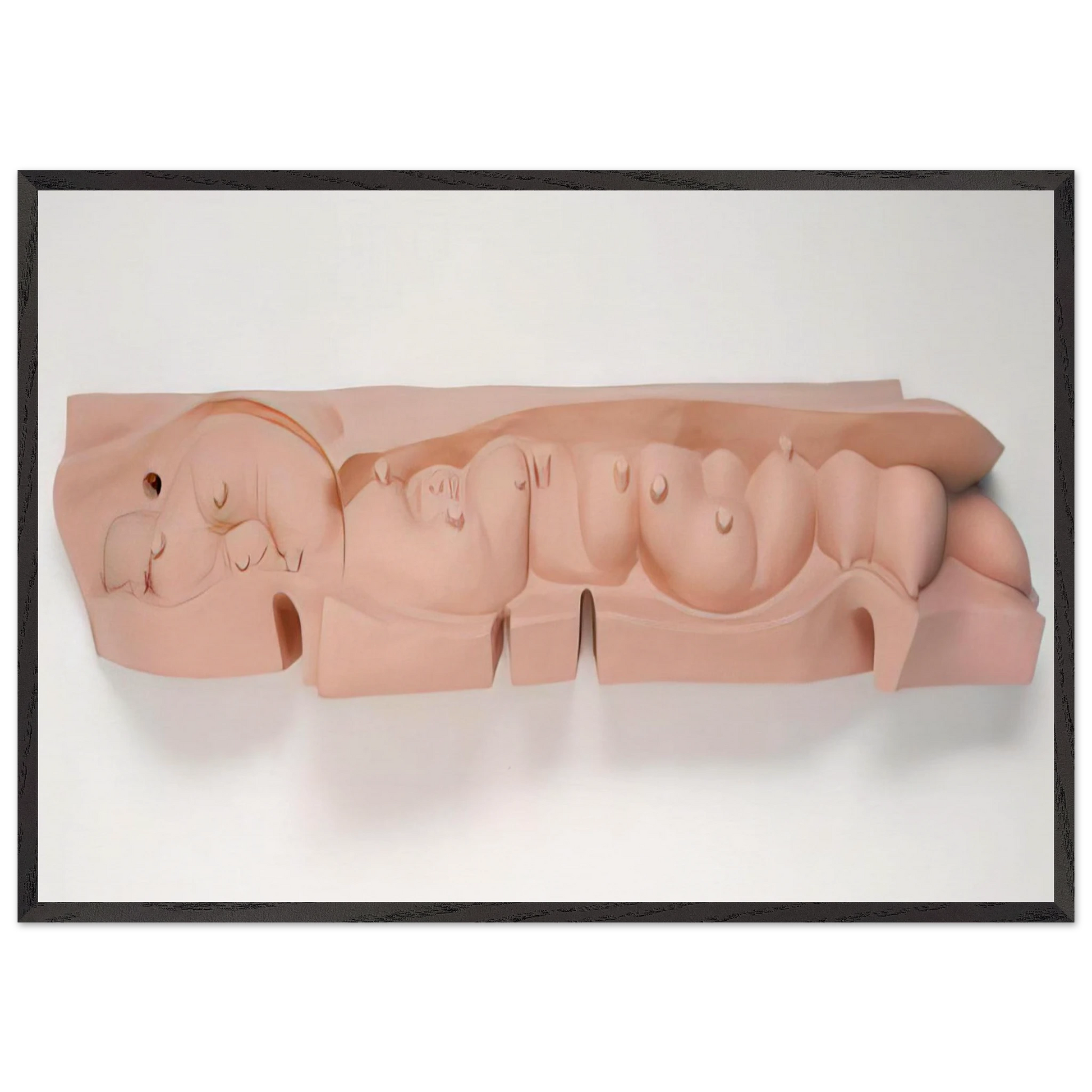 MAMELLES 1991 - Louise Bourgeois Framed Art Print – Black Wooden Frame - Default Title - -Framed Art Print