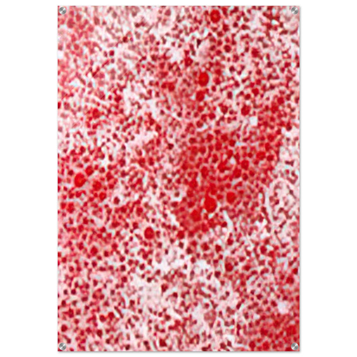 BEYOND THE END OF THE CENTURY 1987 - Yayoi Kusama Acrylic Print - 70x100 cm / 28x40″ inches