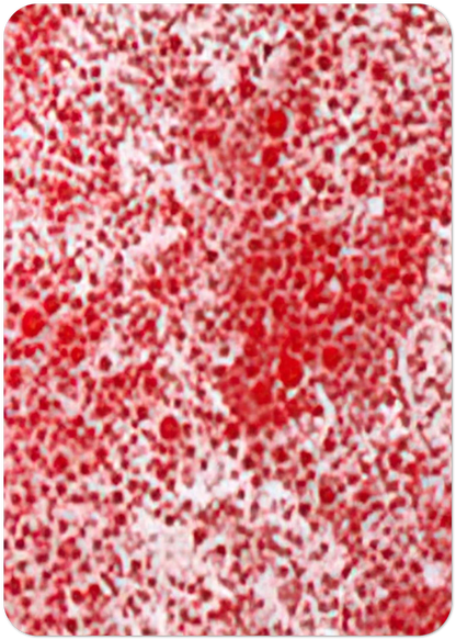BEYOND THE END OF THE CENTURY 1987 By Yayoi Kusama Pack of 10 Post Cards | Yayoi Kusama Post Cards | A6 (10.5 x 14.8 cm) - 4.1 x 5.8 inches